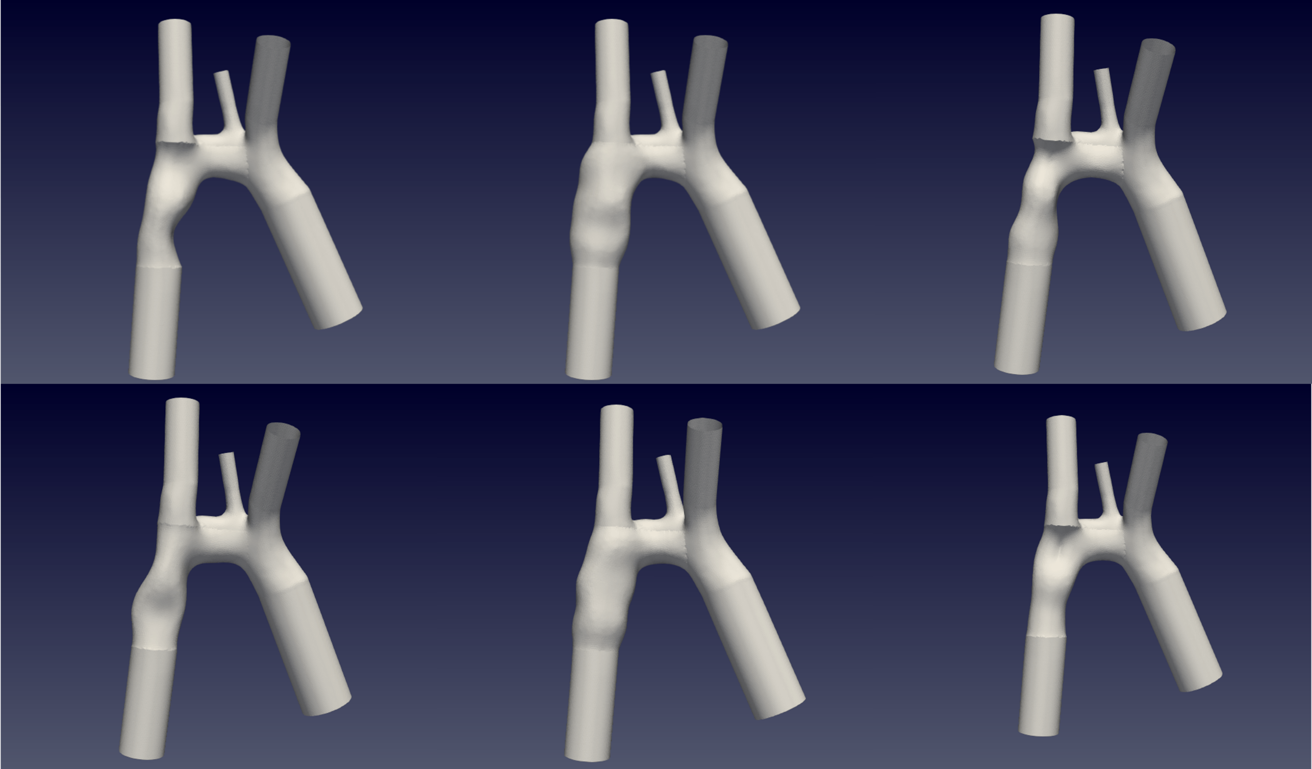 3D rendered model of simulated artery contractions for blood circulation